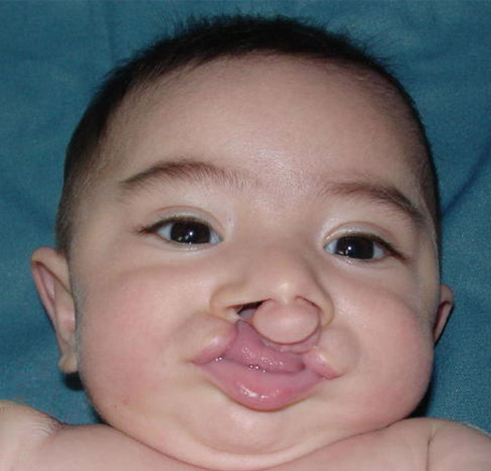 Maximiliano as a baby