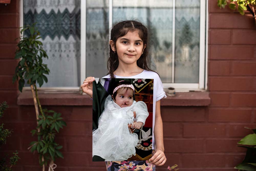 Aylen holds up a picture of herself before cleft surgery