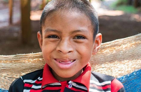 Auner smiling after cleft surgery