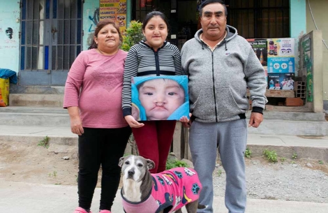 Chiara and her family holding a picture of her before cleft surgery